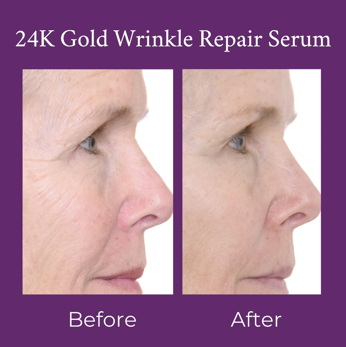 Side profile of 24K Gold Wrinkle Repair Serum bottle showing elegant design.