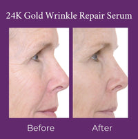 Side profile of 24K Gold Wrinkle Repair Serum bottle showing elegant design.