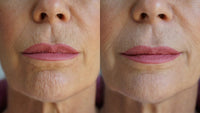 Diagram highlighting key problem areas treated by the Ageless Lip & Line Filler on face illustration.