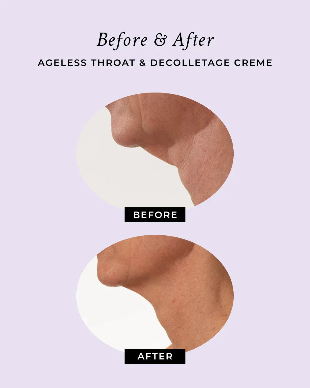 Comparison of sagging neck skin before using the anti-aging neck creme.