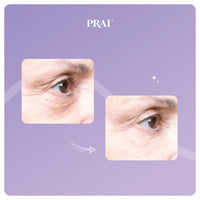 Visual showing before and after eye area, illustrating tighter, lifted eyelids